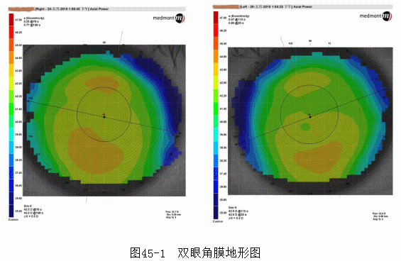ZY016_247_2.gif